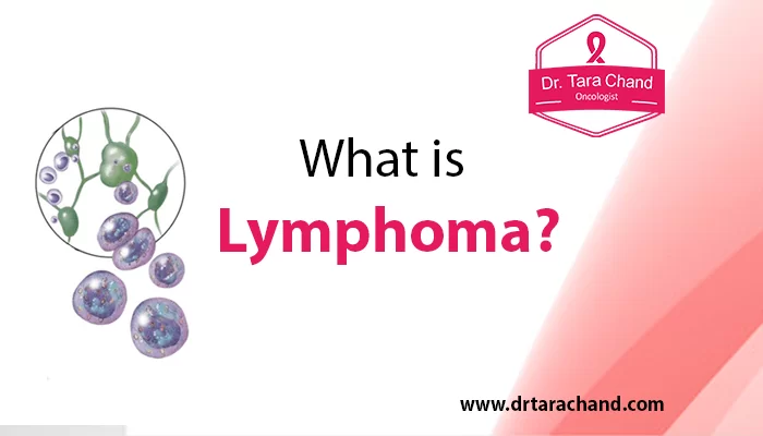 What is Lymphoma?