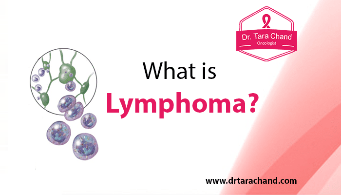 What is Lymphoma?