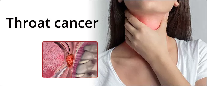 Throat cancer treatment in Jaipur