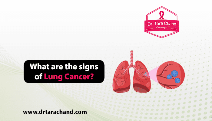 What are the Signs of Lung Cancer in 2022?