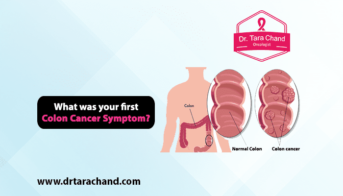 What was your first Colon Cancer Symptom in 2022?