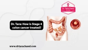 How is stage 4 Colon Cancer Treated in 2022?