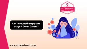 Can immunotherapy cure stage 4 colon cancer in 2022