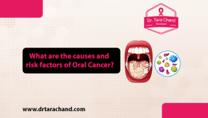 What are the causes and risk factors of Oral Cancer in 2022?