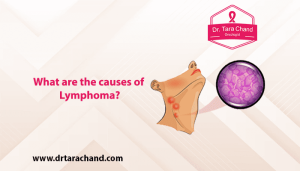 What are the causes of Lymphoma in 2022?