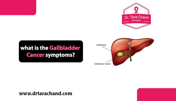 What are the Gallbladder Cancer Symptoms in 2022?