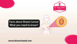 Facts about Breast Cancer: What You Need to Know 2022