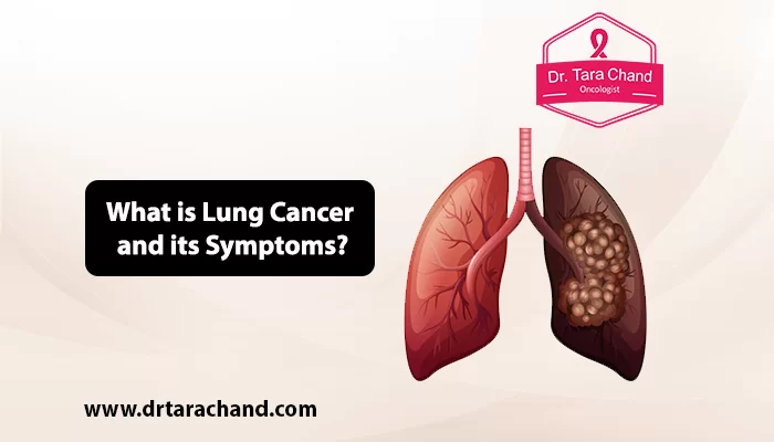 What is Lung Cancer and its Symptoms in 2022?