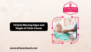 10 Early Warning Signs and Stages of Colon Cancer in 2022