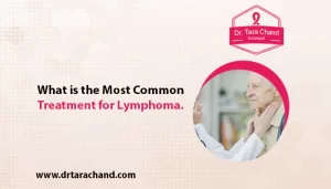 What is the Most Common Treatment for Lymphoma in 2022