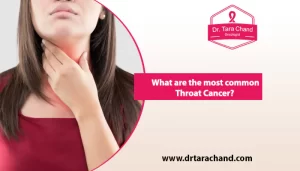 What are the most common Throat Cancer in 2022?