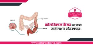 कोलोरेक्टल कैंसर क्यों होता है जाने लक्षण और उपचार !