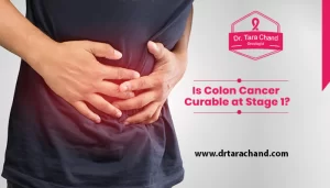 Is colon cancer curable at stage 1?