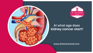What age does kidney cancer start?