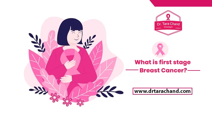 What is the first stage breast cancer?