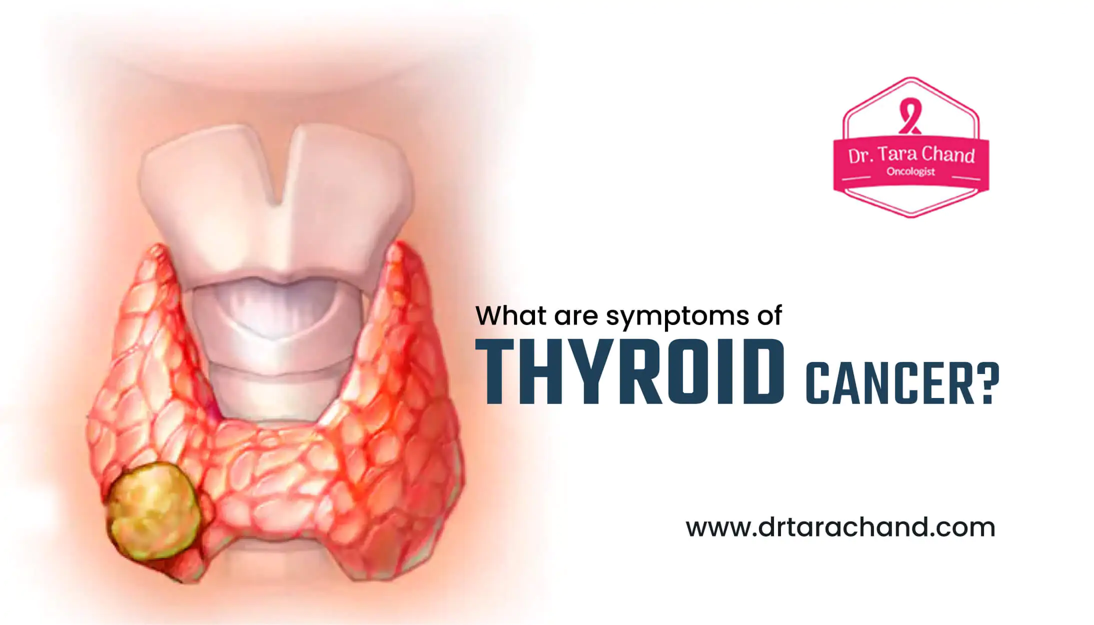 What are the symptoms of thyroid cancer?