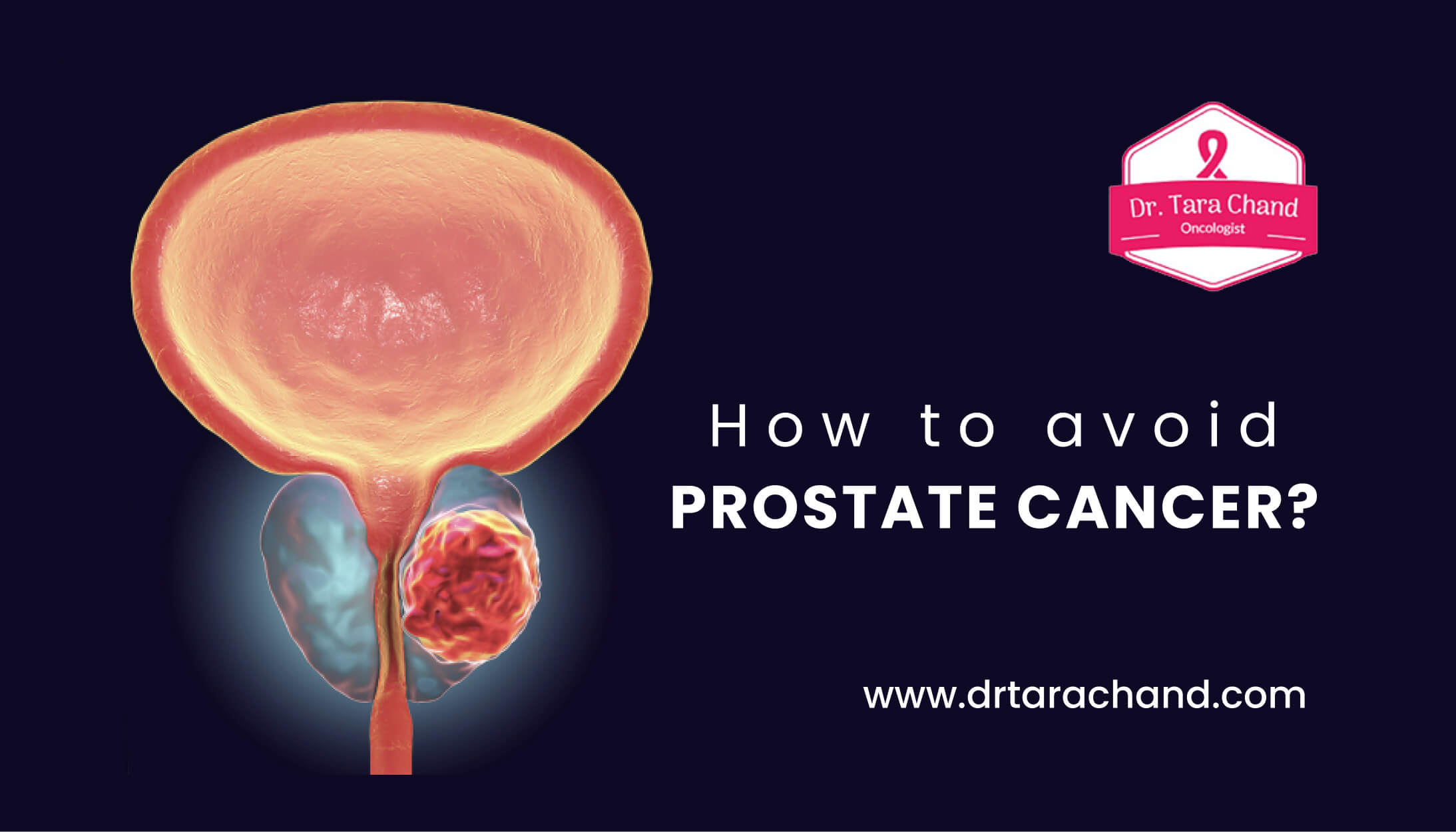Tips to Avoid Prostate cancer