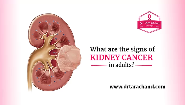 What are the signs of kidney cancer in adults?
