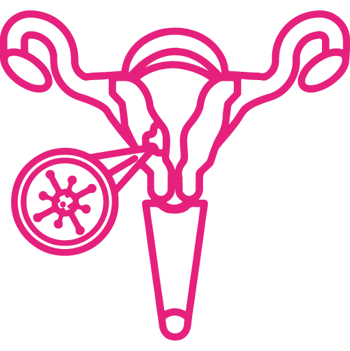 Endometrial Cancer