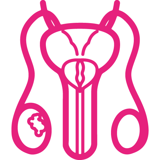 Testicular Cancer