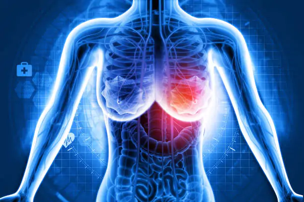 nonsurgical-treatment