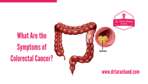 What Are the Symptoms of Colorectal Cancer?