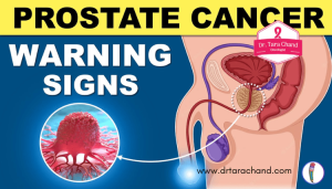 What are the top 10 signs of Prostate Cancer?