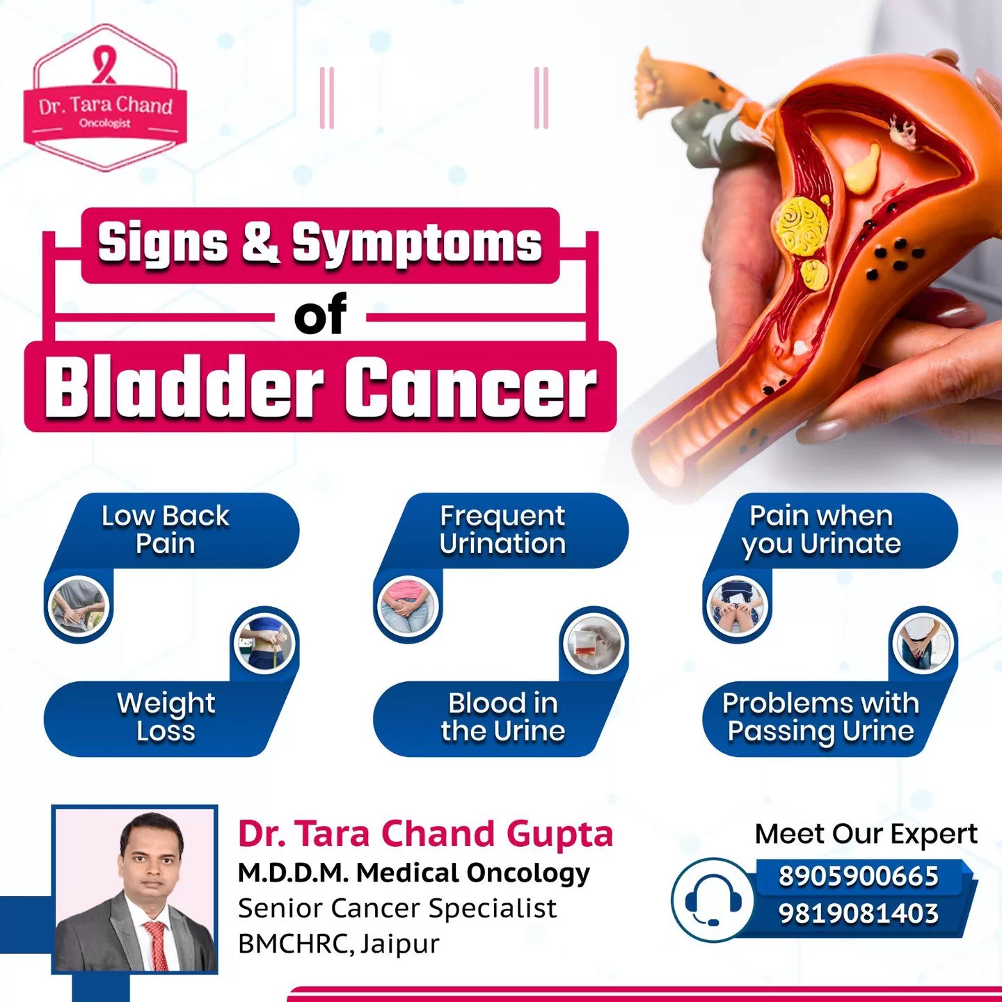 Signs & Symptoms of Bladder Cancer