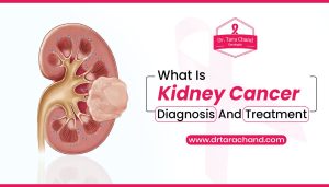 Dr. Tarachand- What is Kidney Cancer – Diagnosis and Treatment
