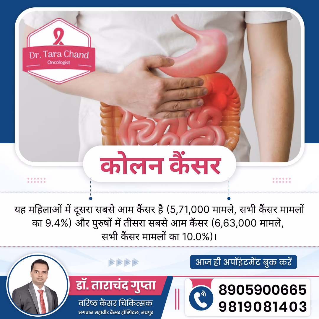 कोलन कैंसर