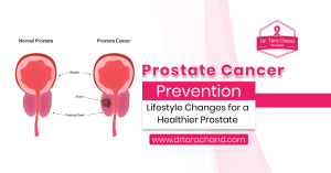 Prostate Cancer Prevention: Lifestyle Changes for a Healthier Prostate!