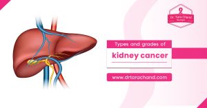 Types and grades of kidney cancer!