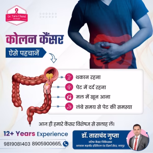 Colon Cancer Signs