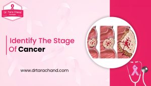 Identify the Stage of Cancer