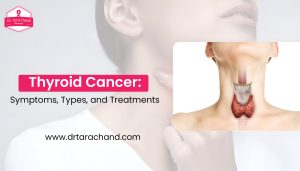 Thyroid Cancer: Symptoms, Types, and Treatments