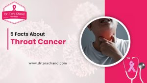 5 Facts About Throat Cancer