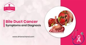 Bile Duct Cancer: Symptoms and Diagnosis