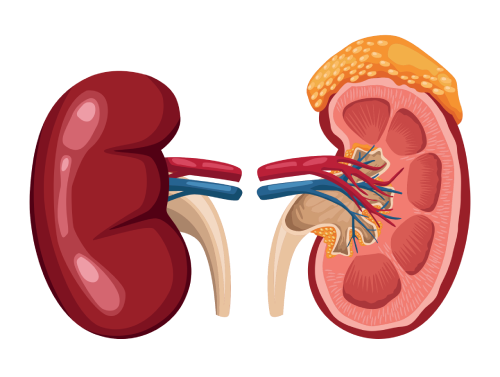 Kidney Cancer Treatment in Jaipur