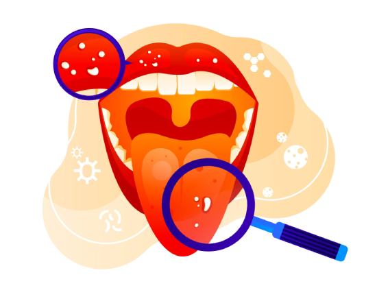 Oral Cancer why choose