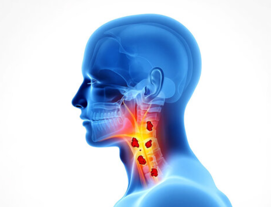 Throat Cancer Treatment in Jaipur
