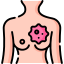 A lump or thickening in the breast or underarm does not disappear.