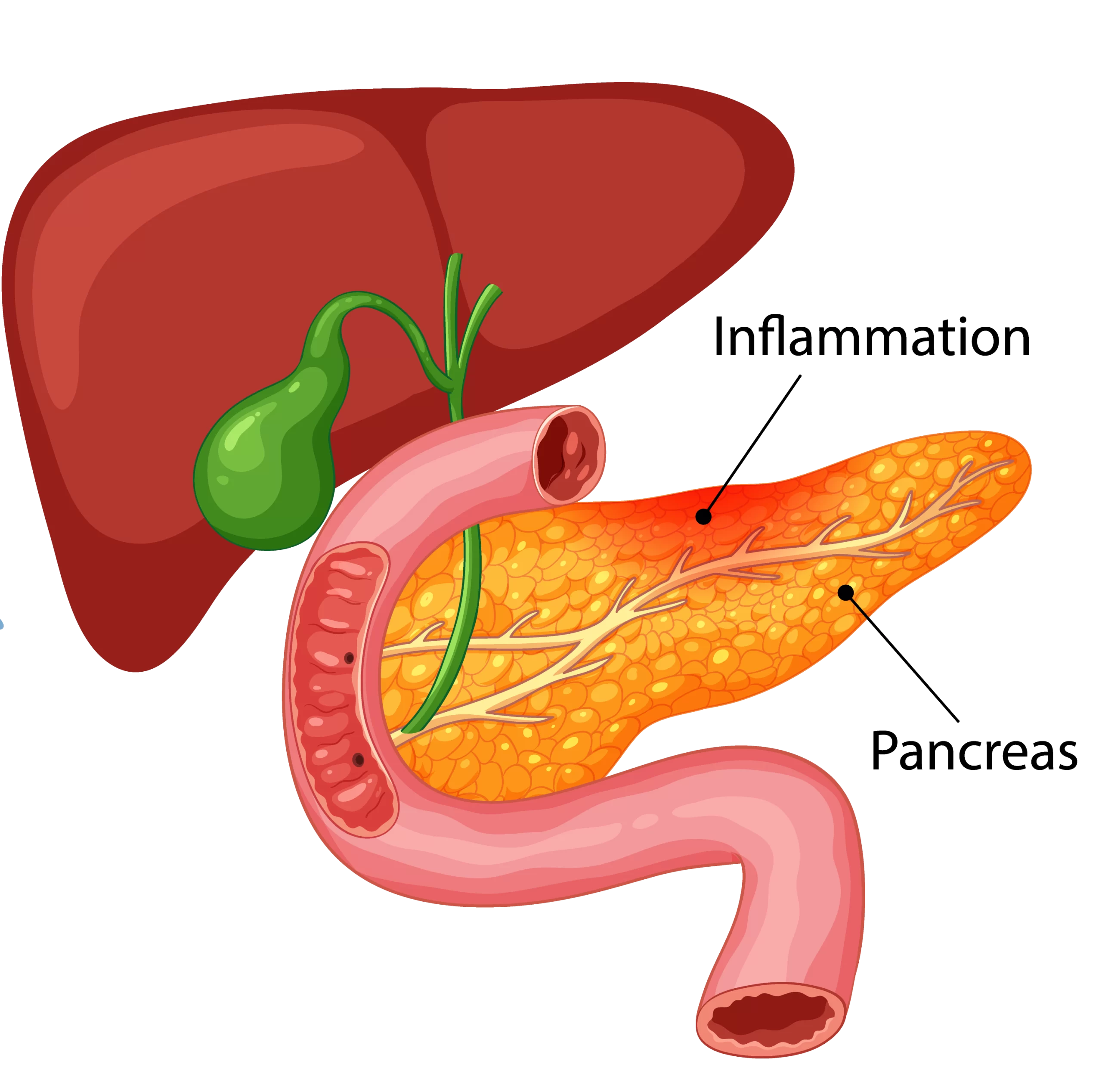 Gallbladder cancer treatment in Jaipur 