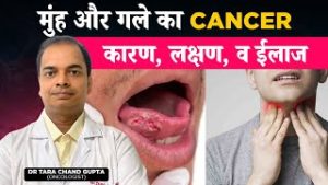 मुंह और गले का कैंसर क्यों होता है? कारण लक्षण व ईलाज | Full Information About Mouth & Throat Cancer