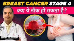 Stage 4 Breast Cancer का इलाज संभव है? | Last Stage Breast Cancer Treatment