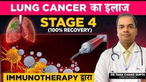 LUNG CANCER Stage 4 का इलाज Immunotherapy द्वारा | क्या Immunotherapy से Lung Cancer ठीक होता है?