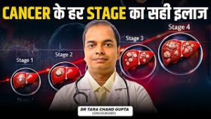 Cancer के हर Stage का इलाज | Stage Wise Cancer Treatment पूरी जानकारी | Dr. Tara Chand Gupta