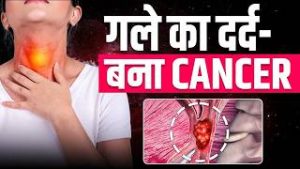 गले में दर्द और खराश — क्या ये कैंसर का संकेत है? | Early Signs of Throat Cancer