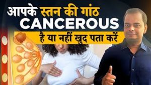 BREAST CANCER Self Examination: आपके स्तन की गांठ Cancerous है या नहीं, खुद पता करें