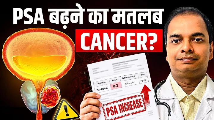 क्या High PSA हमेशा Prostate Cancer का संकेत होता है?